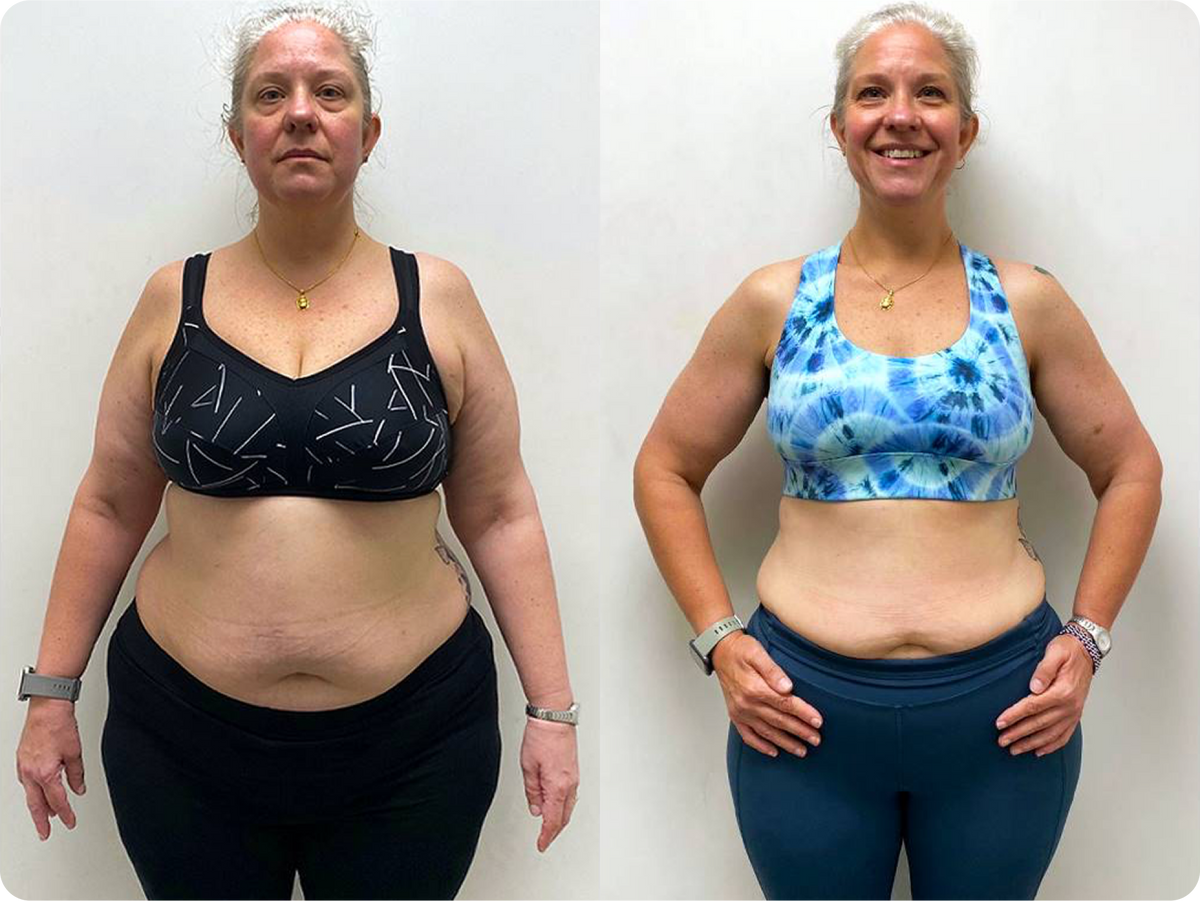 Joanne has lost 15 kg